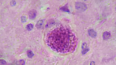 Parásito Toxoplasma gondii. Parásito Toxoplasma gondii.