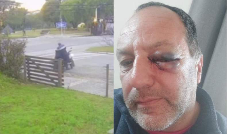 Funcionario municipal agredió a un inspector de tránsito en Florida; la Intendencia inició un sumario