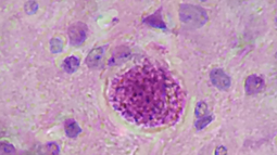 Parásito Toxoplasma gondii.