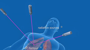 Científicas uruguayas desarrollaron nanopartículas para potenciar la radioterapia contra el cáncer
