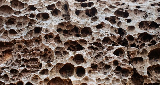 Día Mundial de la Osteoporosis: dos de cada tres mujeres mayores de 50 años tendrán una fractura por fragilidad