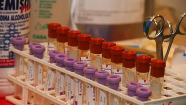 Conozca el día y lugar donde estará el Hemobus para donar plasma