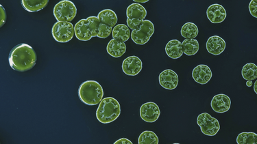 Recomiendan evitar cursos de agua por presencia de cianobacterias en la Laguna del Sauce.