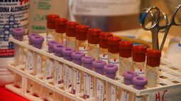 Se desarrolla una jornada de donación de plasma en Maldonado