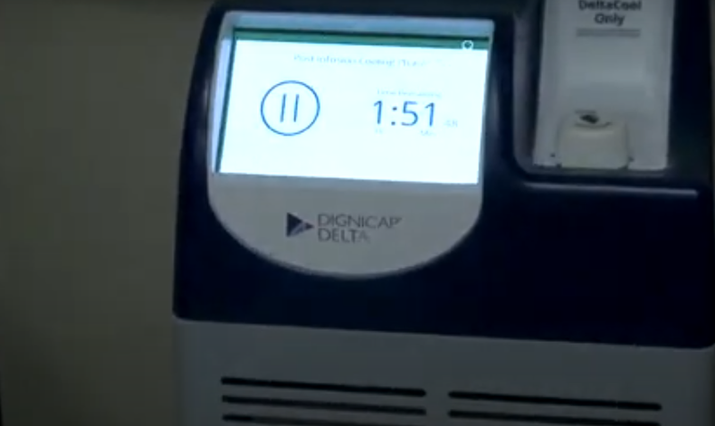 El Hospital de Clínicas presentó este viernes su segundo dispositivo que previene la caída del cabello por quimioterapia en mujeres con cáncer de mama.