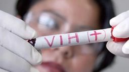 Jornada de test gratuitos para detección del VIH en la Plaza Cagancha este viernes