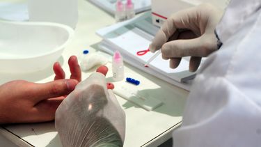 Se estima que en Uruguay hay unas 13 mil personas con VIH