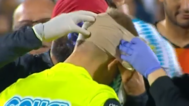 Agresión al asistente Julián Pérez en el partido Defensor - Cerro.