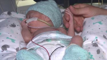 Las historias de familias con hijos prematuros: acompañamiento y cercanía