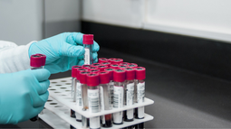 Donación de sangre en la Fing.