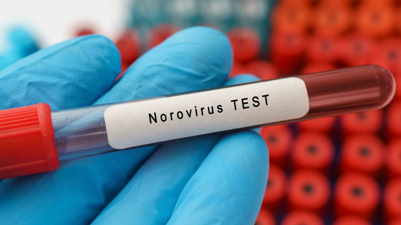 Norovirus.&nbsp;