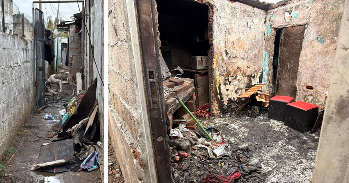 Murió el joven que sufrió graves quemaduras en un incendio q
