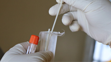 MSP cambió los criterios de vigilancia epidemiológica