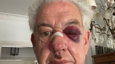 El ingeniero Pablo Carrasco sufrió una brutal agresión tras una rapiña