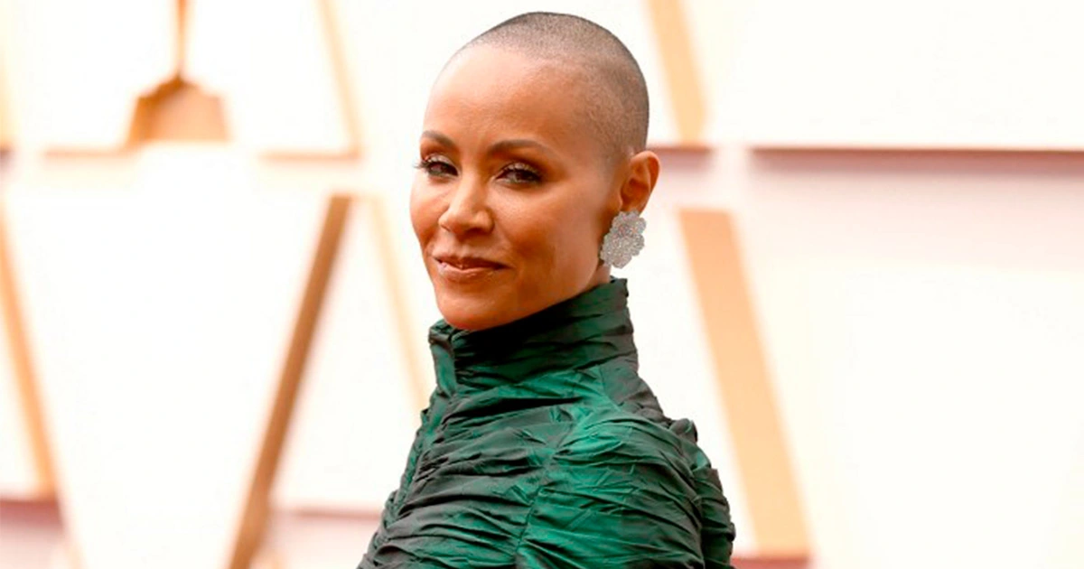 ¿Qué Es La Alopecia, Enfermedad Que Padece Jada Pinkett Smith?