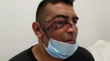 Fueron a colaborar con Bomberos, los insultaron y atacaron con piedras